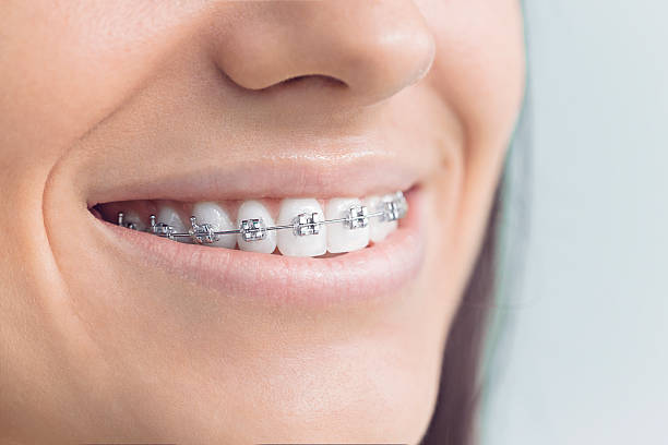 Best Dental Fillings (Composite and Amalgam)  in Pascoag, RI